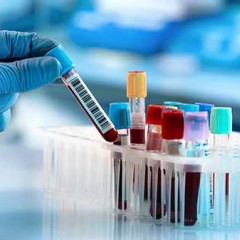 RN 453/2020: regulamenta a cobertura obrigatória e a utilização de testes diagnósticos para infecção pelo Coronavírus