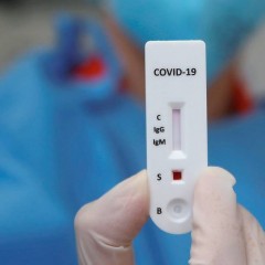 Publicada a decisão que suspende a obrigatoriedade de cobertura dos testes de IgM e IgG, mas ANS delibera sobre a manutenção da vigência da RN 458