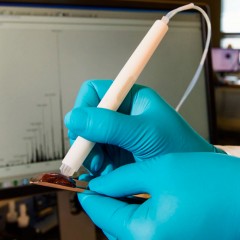 Cientista brasileira inventa ‘caneta’ que detecta câncer durante cirurgia
