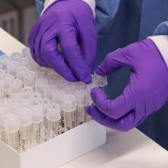 Funcional lança plataforma para análise de dados sobre o coronavírus