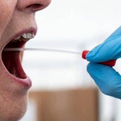 Ministério da Saúde inclui novos exames para o diagnóstico laboratorial do Coronavírus, na Tabela de Procedimentos do Sistema Único de Saúde (SUS)