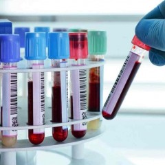 Exame IgG e IgM voltou a ser obrigatório com Diretriz de Utilização