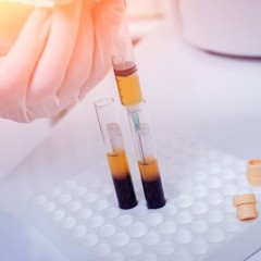 (Inglês) Possível tratamento da COVID, baseado em transfusão de sangue de pacientes curados