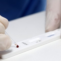 Acontecerá hoje reunião técnica da ANS sobre testes sorológicos para Covid-19