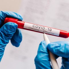 ANS realiza reunião técnica sobre teste sorológico para Covid-19